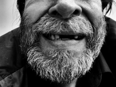 client-mouth-beard-bw
